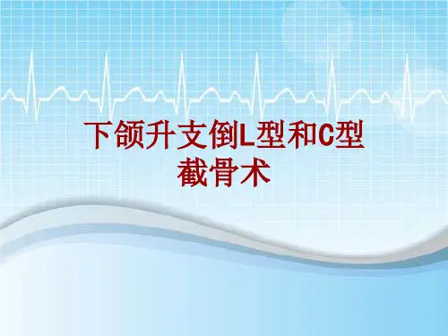 手术讲解模板：下颌升支倒L型和C型截骨术