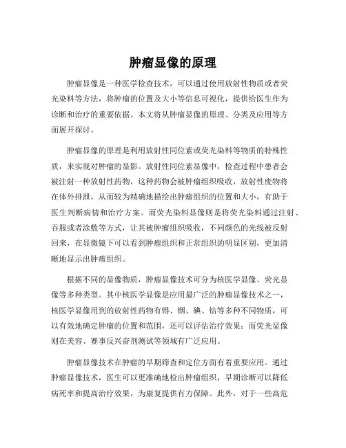 肿瘤显像的原理