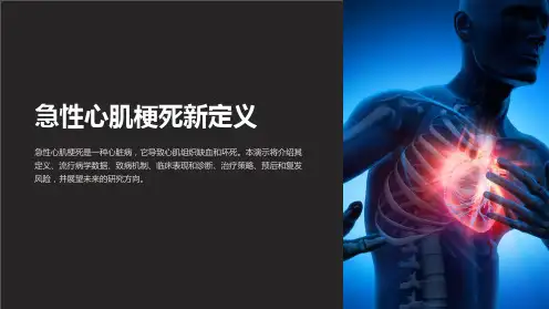 急性心肌梗死新定义