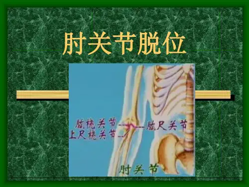 肘关节脱位课件PPT