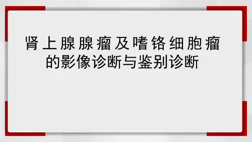 肾上腺腺瘤与嗜铬细胞瘤的影像诊断与鉴别诊断