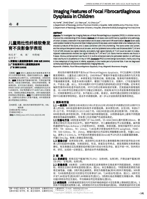 儿童局灶性纤维软骨发育不良影像学表现