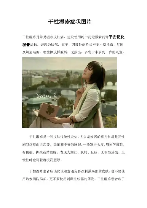 干性湿疹症状图片