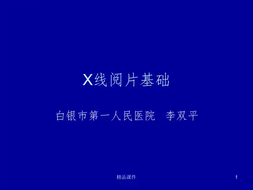 X片读片基础ppt课件