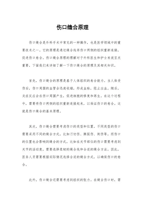 伤口缝合原理