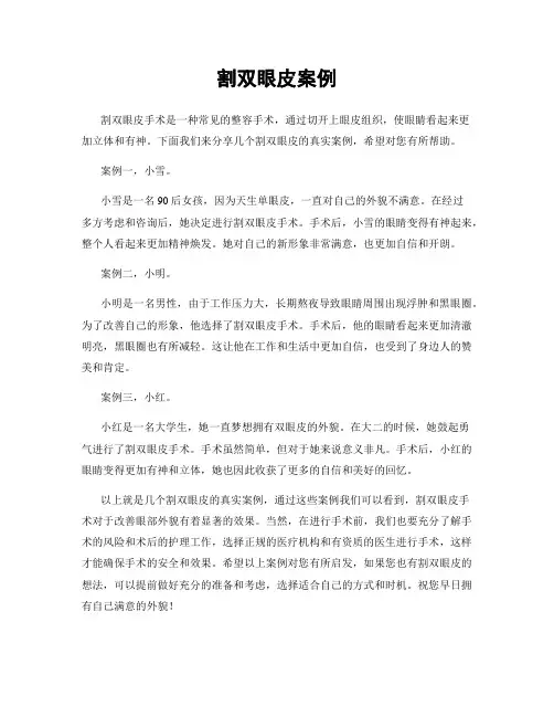 割双眼皮案例