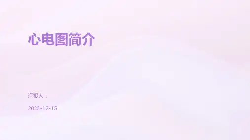 心电图简介