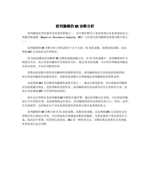 前列腺癌的MR诊断分析