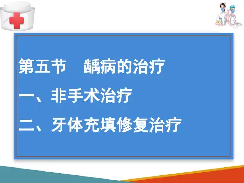 龋病的治疗(口腔内科学课件)