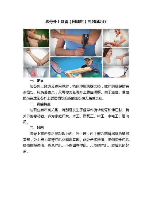 肱骨外上髁炎（网球肘）的封闭治疗