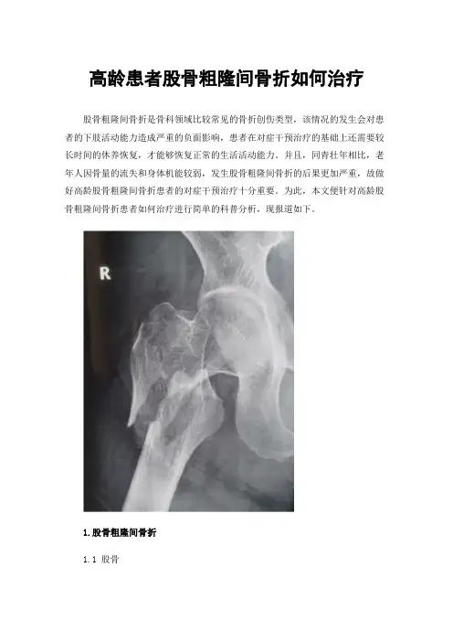 高龄患者股骨粗隆间骨折如何治疗