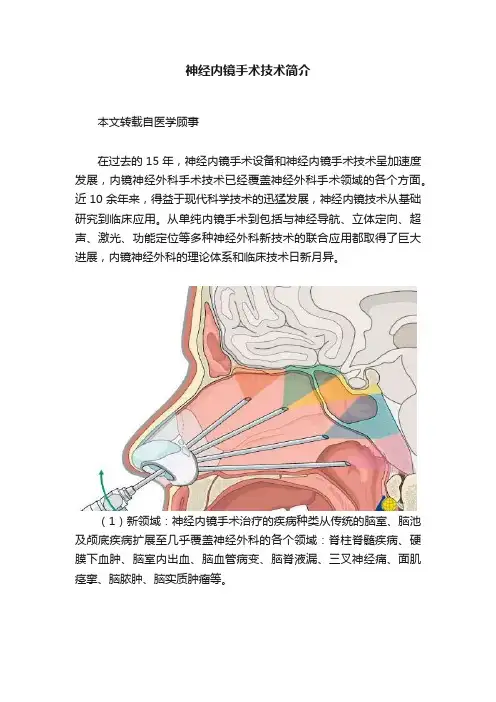 神经内镜手术技术简介