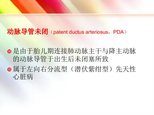 动脉导管未闭封堵术的护理精品PPT课件