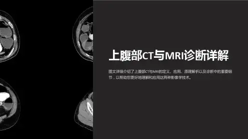 上腹部ct与mri诊断详解课件