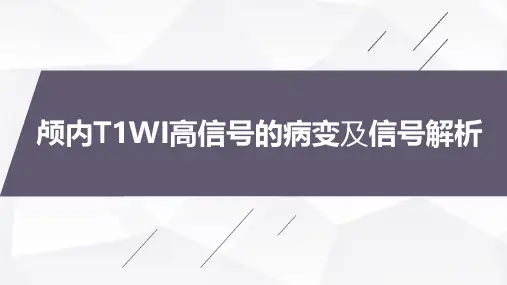 颅内T1WI高信号的病变及信号解析