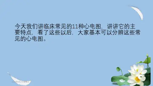 简简单单看懂心电图课件