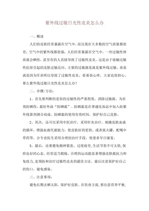 紫外线过敏日光性皮炎怎么办