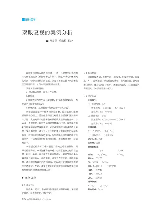 双眼复视的案例分析
