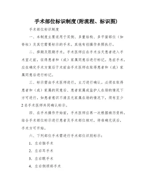 手术部位标识制度(附流程、标识图)