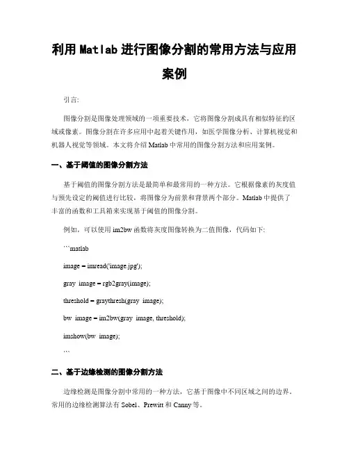 利用Matlab进行图像分割的常用方法与应用案例