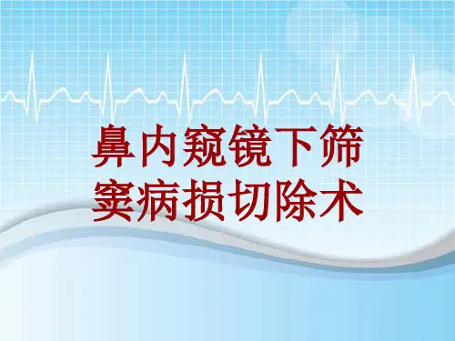 手术讲解模板：鼻内窥镜下筛窦病损切除术