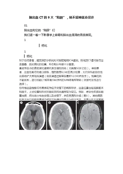 脑出血CT的9大“陷阱”，稍不留神就会误诊