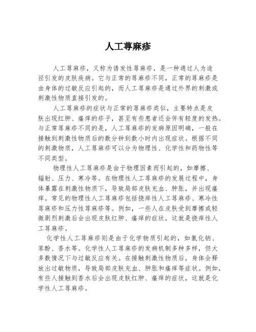 人工荨麻疹