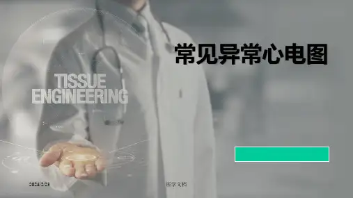常见异常心电图