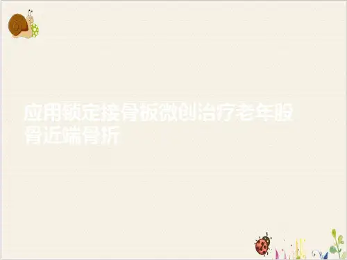 应用锁定接骨板微创治疗老年股骨近端骨折PPT.