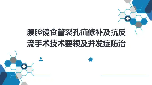 外科学-第二十七章 食管疾病 腹腔镜胃底折叠术技术要领