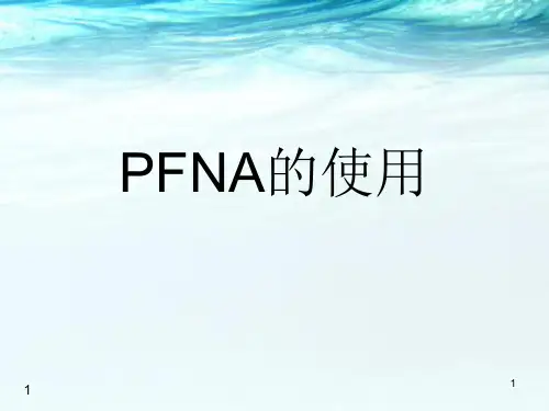 PFNA(股骨近端方旋髓内钉)医学PPT课件