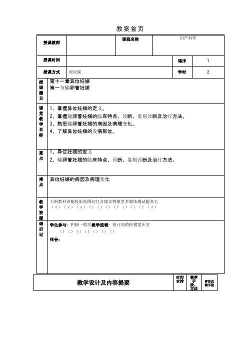 异位妊娠教案