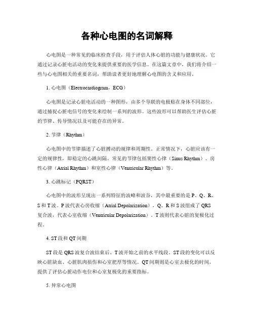 各种心电图的名词解释