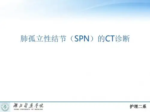 肺孤立性结节SNppt课件