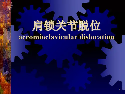 肩锁关节脱位ppt课件