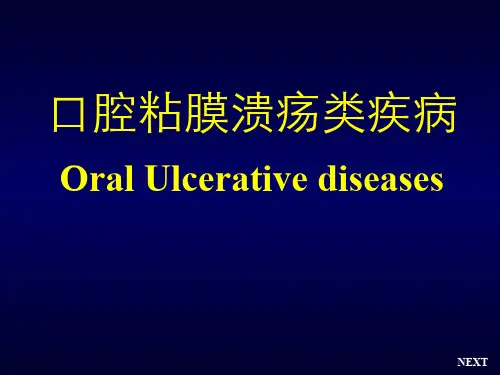 口腔黏膜病学-口腔黏膜溃疡类疾病