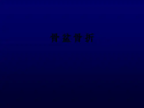 骨 盆 骨 折ppt课件