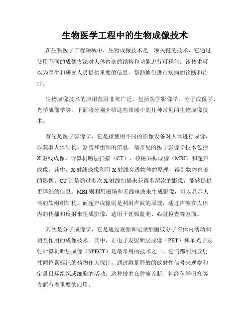 生物医学工程中的生物成像技术