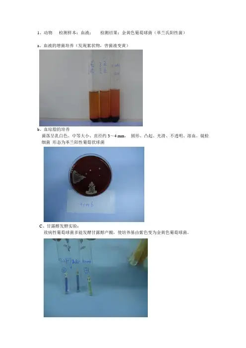 金黄色葡萄球菌检测