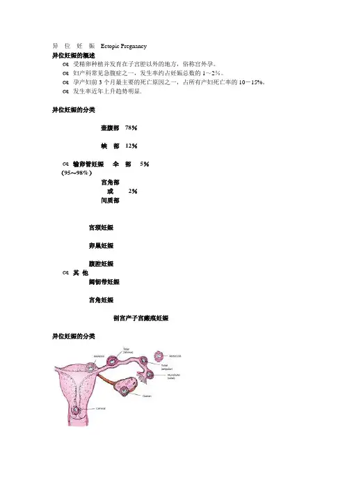 异位妊娠