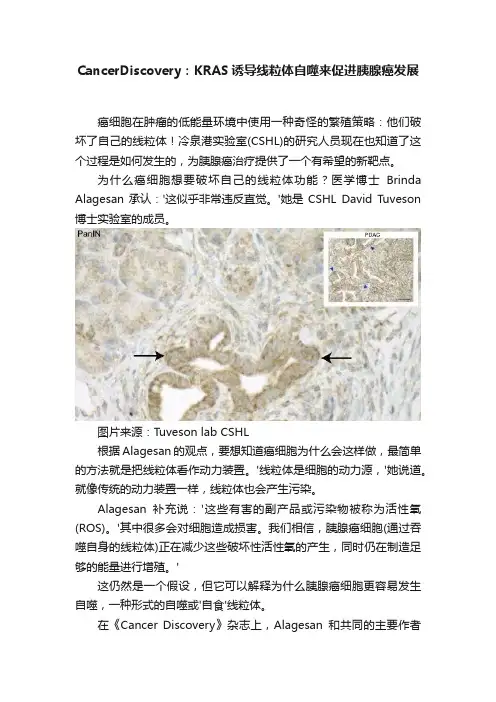 CancerDiscovery：KRAS诱导线粒体自噬来促进胰腺癌发展