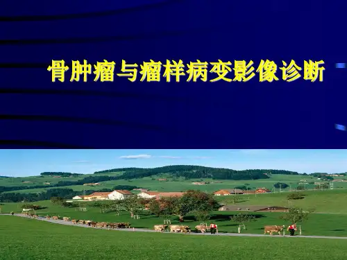骨肿瘤影像诊断