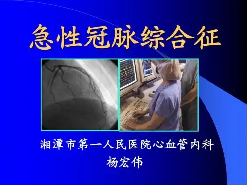 急性冠脉综合征