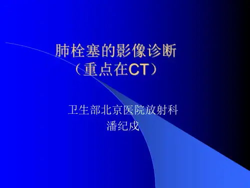 医学影像-肺栓塞的影像诊断