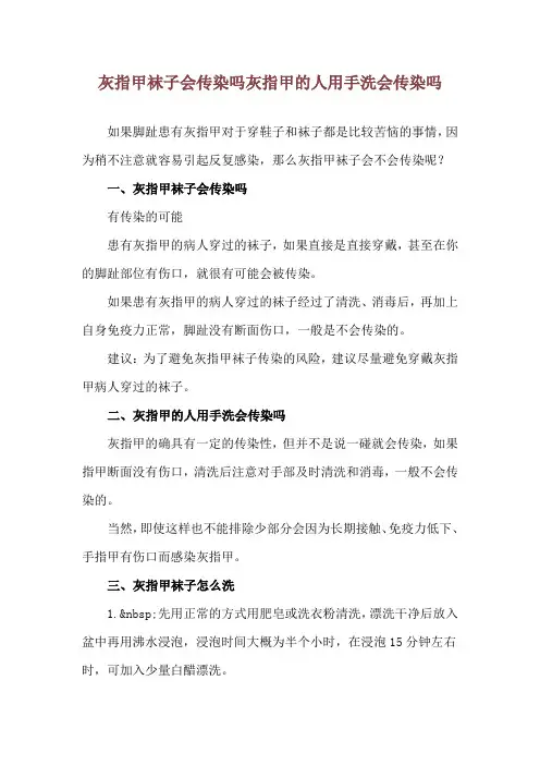 灰指甲袜子会传染吗 灰指甲的人用手洗会传染吗