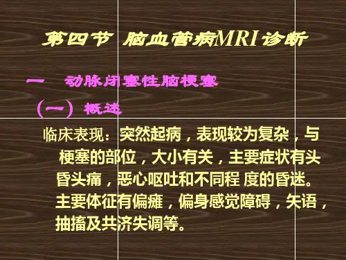 脑血管病的MR诊断ppt课件