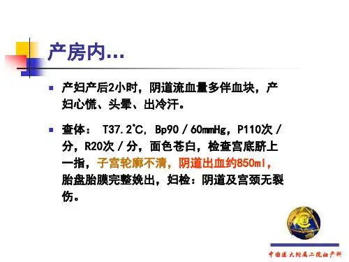 产后出血