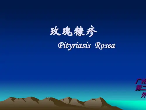 中西医结合课件  玫瑰糠疹