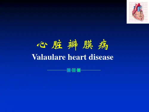 内科学：心脏瓣膜病
