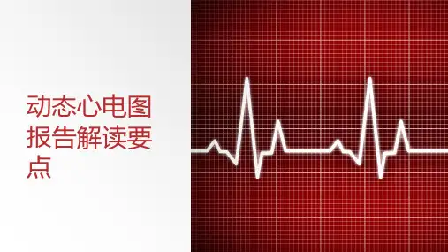 动态心电图报告解读要点
